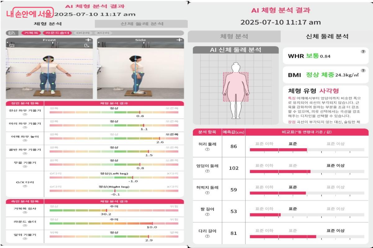 카톡으로 전송받은 체형 불균형 결과지 사진 ©김윤경
