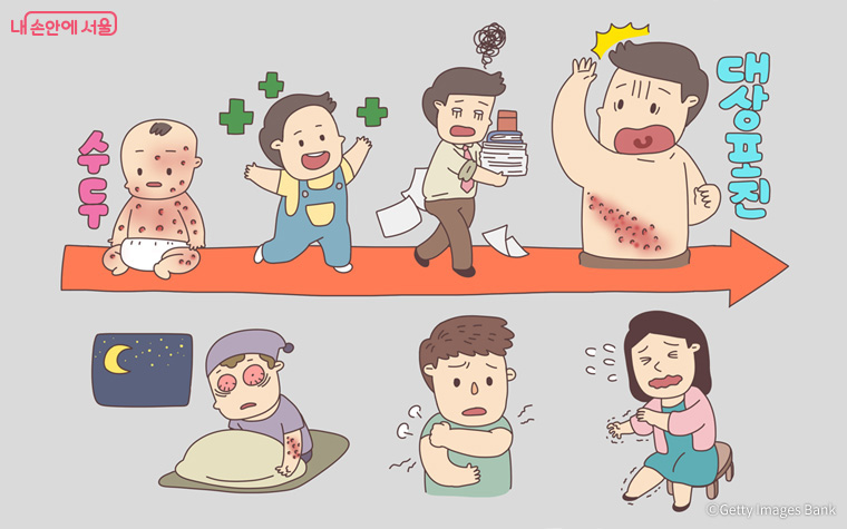 우리나라 사람들에게 꽤나 흔한 질병인 ‘대상포진’